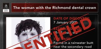 “The Woman with the Richmond Dental Crown” Finally Named After Two Decades Richmond Dental Crown
